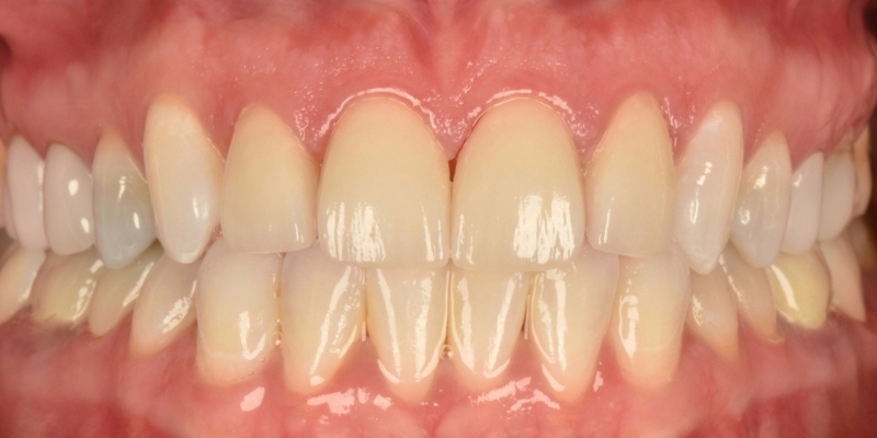 Cosmetic_After
